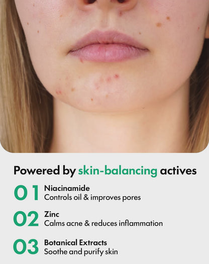 Purify & Balance Face Serum